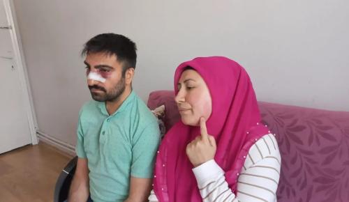Engelli Komşusunun Burnunu Kırdı, Kaynayan Semaveri Üstüne Döktü: Amasya’da Şiddet Olayı
